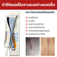 จัดส่งทันที เจลลบรอยแผลเป็น MSLAM Scar cream รอยแผลผ่าตัด สูตรอ่อนโยน ครีมลบแผลเป็น เจลทาลอยแผลเป็น  เห็นผลเร็ว เจลลบรอย20g ครีมดูแลรอยแผลเป็นต่างๆ ครีมทาแผลเป็นจากน้ำลวก เจลทาแผลเป็นนูน