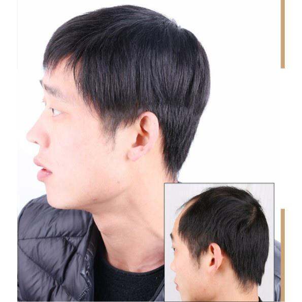 middle-aged-man-wig-dad-wig-natural-short-hair-black-100-real-hair-man-wig-handmade-bald-patch