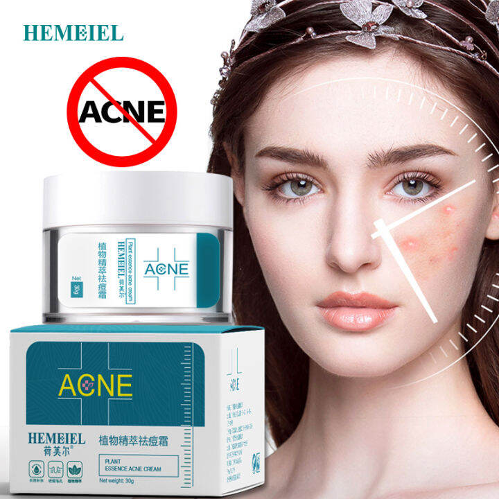 HEMEIEL Acne Remover Cream / Pimples Remover Effective / Pimple Marks ...