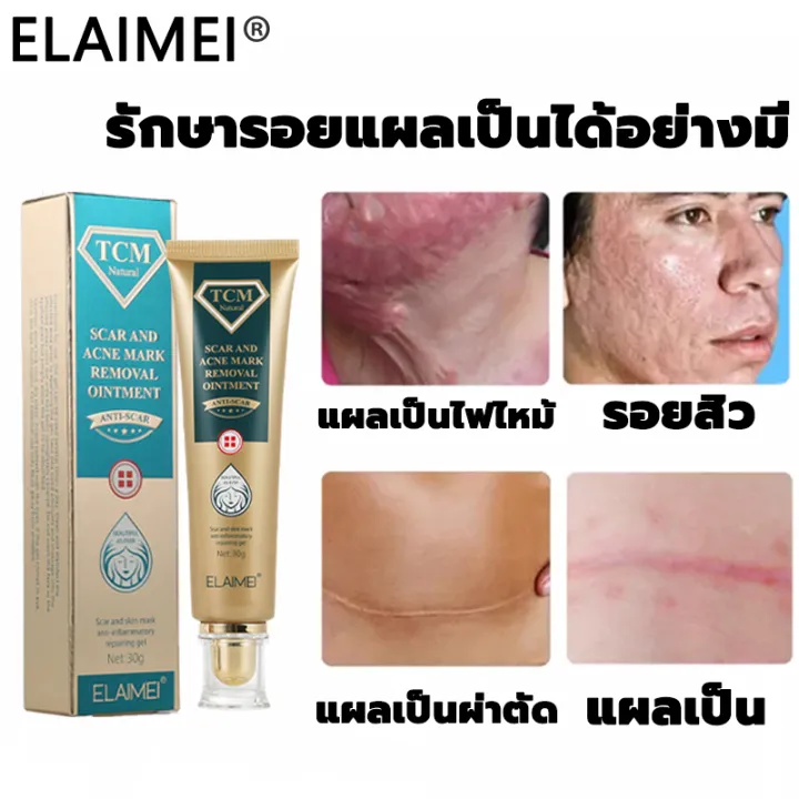 ชิ้นที่2ลด50 ดูดซับง่าย ครีมลบแผลเป็น สำหรับรอยสิว รอยแผลเป็น แผลไฟ