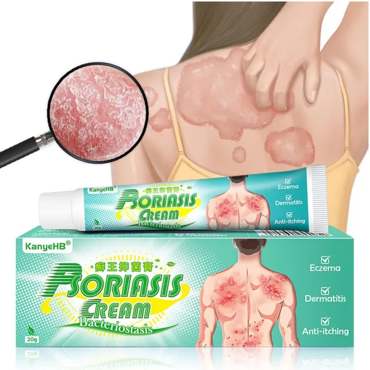 20g Psoriasis Cream Eczema Ointment Scalp Psoriasis Anti-Itch Hand Foot Sweat Cream Inhibit Tinea Tinea Versicolor Fungus B2M4