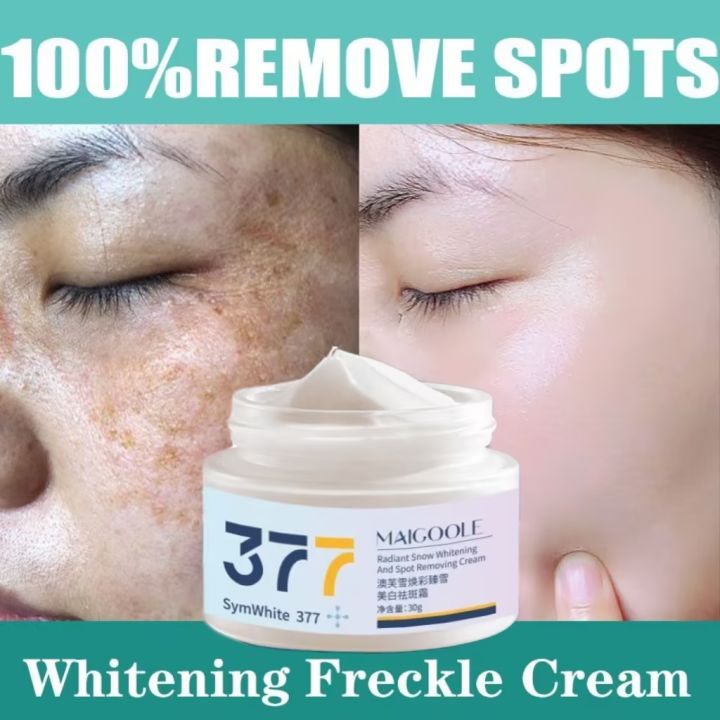 Japanese Melasma Cream Original Whitening Remover Cream For Face