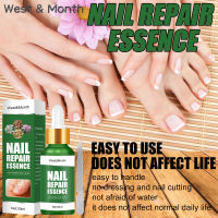 West&amp;Month Nail Repair Essenceซ่อมเล็บที่ชำรุด น้ำยาซ่อมแซมเล็บ น้ำยารักษาเล็บ เซรั่มบำรุงเล็บดูแลเล็บ เซรั่มรักษาเล็บ เซรั่มซ่อมแซมเล็บ เชื้อราเล็บมือ ยาฆ่าเชื้อราที่เล็บ น้ำยาบำรุงเล็ ยารักษาเชื้อราเล็บ รักษาเล็บเสีย รักษาโรคเชื้อราที่เล็บ ครีมบำรุงเล็บ