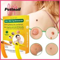 PETINAIL อุปกรณ์ล้างหน้ายางกำจัดหูดเครื่องมือกำจัดไฝดูแลผิวหน้าสะอาดเครื่องมือความงามพลาสติกไฝ