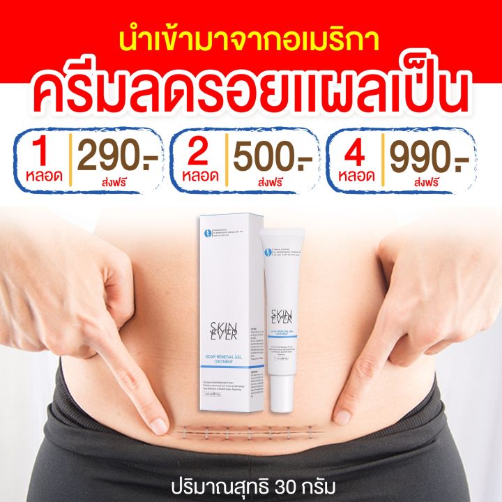 ครีมทาคีลอยด์-1-ชิ้น-170-บาท-30-กรัม-พร้อมส่งในไทย