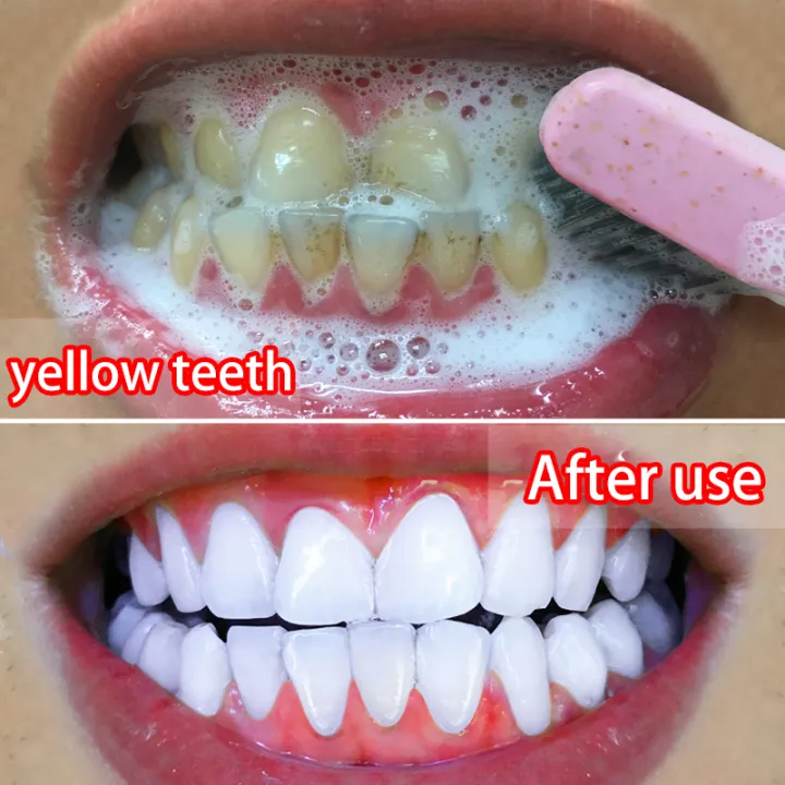 Toothpaste Tooth Whitening Essence Gel Effectively Removes Dental