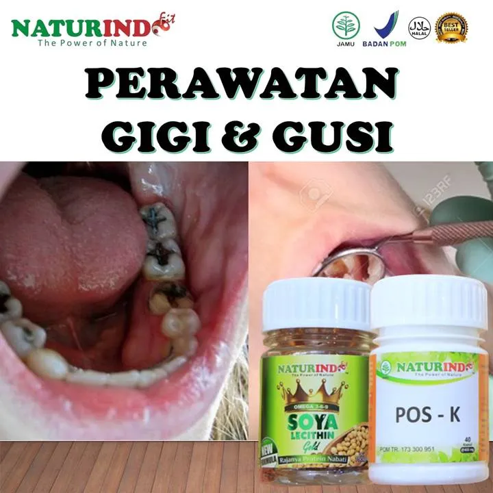 obat herbal sakit gigi bolong di malaysia
