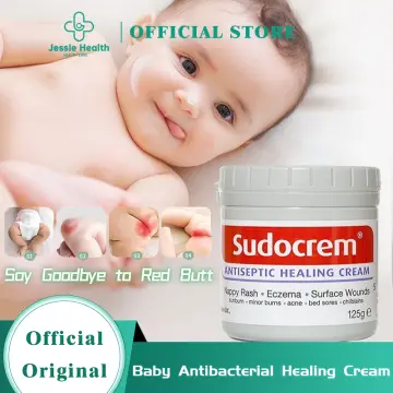 Baby lotion best sale on sunburn