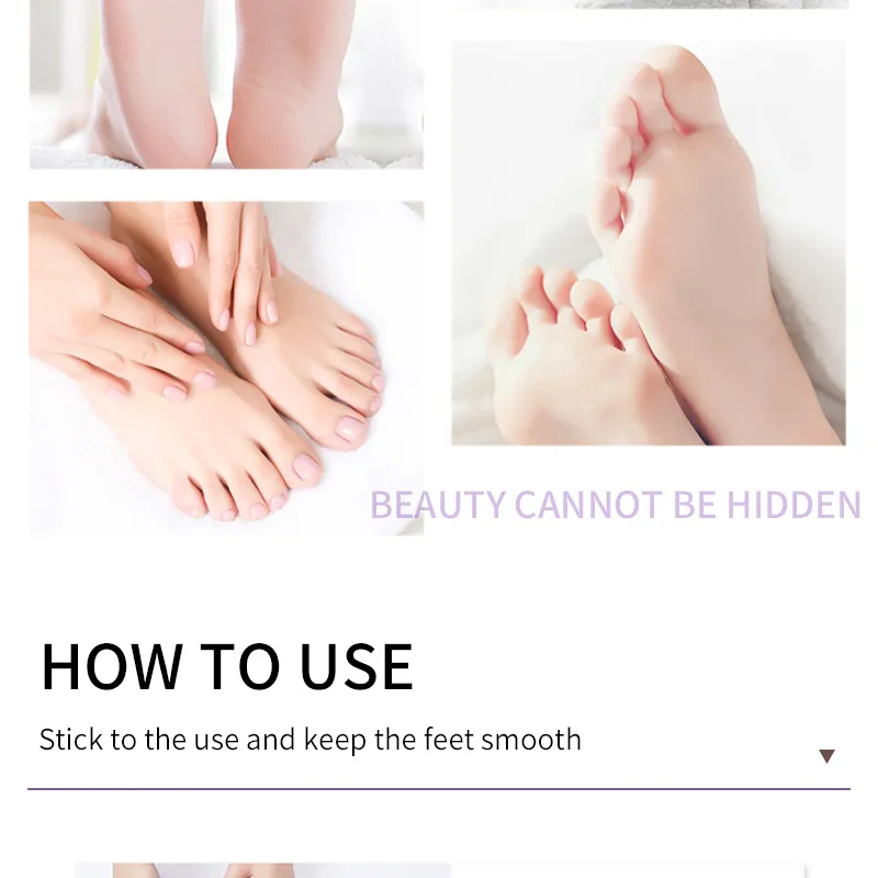 Professional Foot Care Dead Skin Remover – Mavigadget