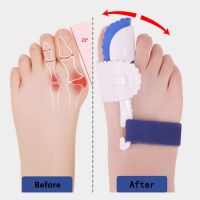 ✑❁ 2Pcs Toe Separator Hallux Valgus Corrector