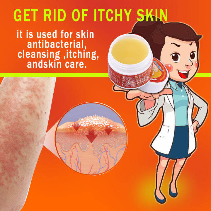 Psoriasis treatment cream eczema erythema itchy hands feet scalp skin