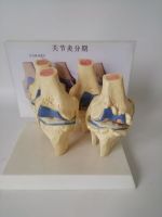 The knee lesions in the knee joint is medical teaching model of human body skeleton model