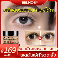 【จัดส่งไว】EELHOE ครีมกำจัดถุงใต้ตา ครีมบำรุงใต้ตา เซรั่มทาถุงใต้ตา 30ml ลบคล้ำบวมใต้ตา กระชับรอยตีนกา บรรเทาปัญหาต่างๆรอบดวงตา (คนีมบำรุงรอบดวงตา ครีมทาตาเม็ดไขมัน ​ครีมบำรุงรอบตา ​เซรั่มถุงใต้ตา ​ครีมทาใต้ตาดำ บำรุงสายตา ครีมทาตาดำ）