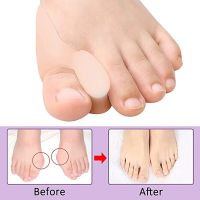 ✇✤❖ Big Toe Straightener Foot Fingers Toe Separator Thumb Valgus Protector Silicone Gel Bunion Adjuster Feet Pads Relief Foot Pain