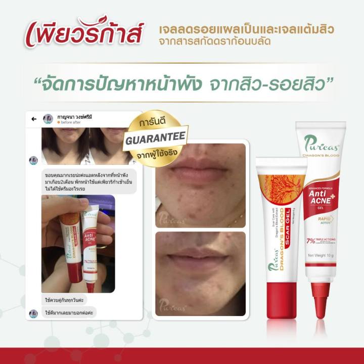 puricas-anti-acne-gel-เพียวริก้า-แอนติ-แอคเน่-เจล-10-กรัม-เจลแต้มสิว