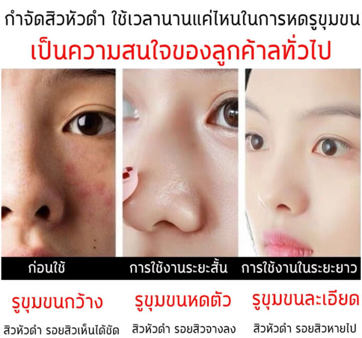 ครีมล้างหน้า-โฟมล้างหน้า-vcเฟเชียล-face-cleanser-ไวท์เทนนิ่ง-ทำความสะอาดล้ำลึก-อ่อนโยนและไม่ตึง-บำรุงผิวหน้า-ให้ความชุ่มชื้น-เรียบเนียน