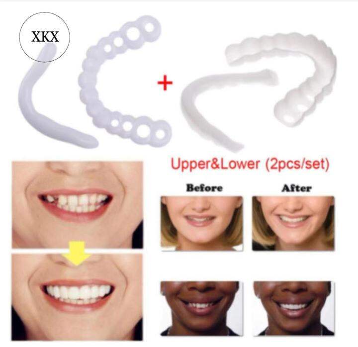 Buy 1 take 1 ) Snap On Smile Teeth One Size Fits Snapon Snapon Smile