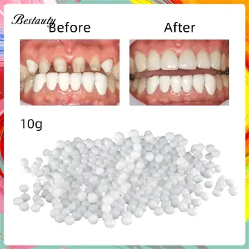 Tooth Repair Kit, 100 g Moldable Thermal Fitting Beads for Filling Fix  Missing and Broken Teeth or Adhesive Denture Fake Teeth