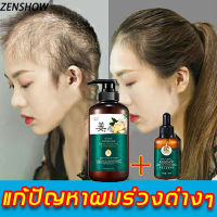 【พร้อมส่ง】ZENSHOW แชมพูแก้ผมร่วง เซรั่มยาสระผมขิง 500ml+30ml（แชมพูเร่งผม×10 แชมพูขิงเพียว ยาสระผมขิง แชมพูแก้ผมร่วงขิง แชมพูขิง ​แชมพูผมดก แชมพูกันผมร่วง แชมพปลูกผมดก เซรั่มขิงบำรุงผม แชมพูปลูกผม ผมร่วงผมบาง）