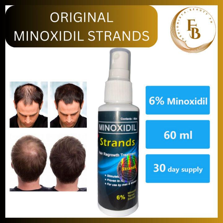 Minoxidil Strands 6% Minoxidil Topical Solution (60ml per bottle) Hair ...