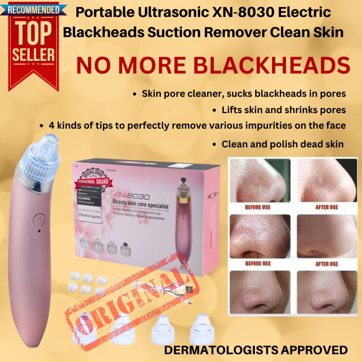 100 Original Portable Ultrasonic XN8030 Electric Blackheads Suction