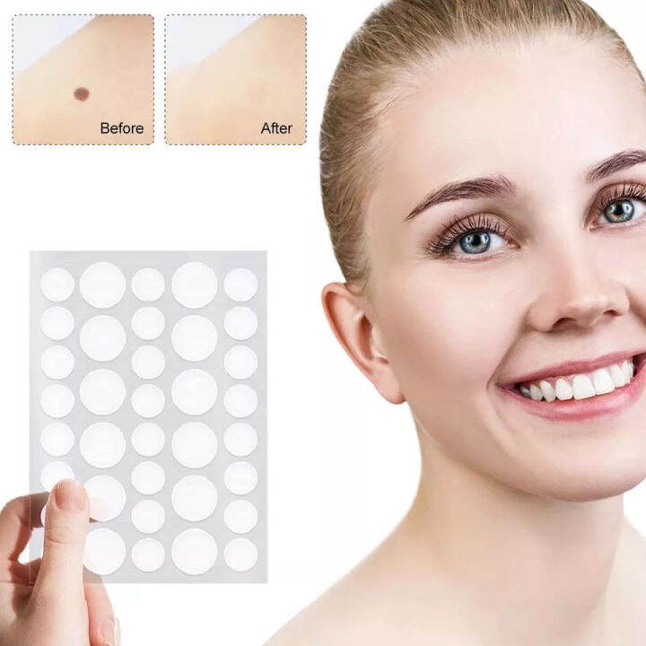 Acne Patch36pcs lnvisible Acne Pimple Removal Patch Acne Hydrocolloid ...