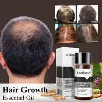 LANBENA น้ำมันหอมระเหยเจริญเติบโตของเส้นผมรักษาผมร่วงป้องกันหัวล้านปลูกผมสำหรับผู้ชายและผู้หญิงผมหนาผมที่มีประสิทธิภาพดูแลผม20ml Hair Growth Essential Oil Hair Care