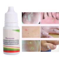 10ml ส่วนผสมจากธรรมชาติ Skin Care Wart Remover Skin Tag Remover Liquid