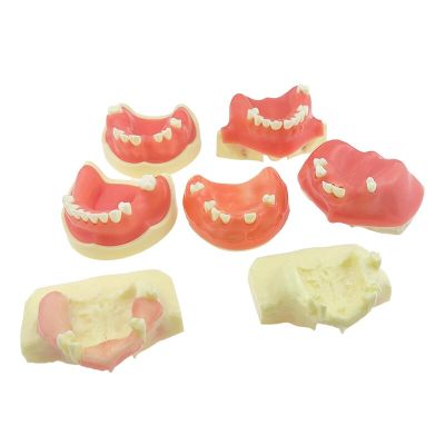 1PCS Dental Implant Disease Teeth Model Dental Sinus Lift Practice Teeth Model Dental Teaching Model Orthodontic Model