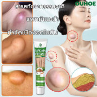 แท้OUHOE ออกแบบ36ชนิดของไขมันใต้ผิวหนังกำจัดมวลก้อนไปยังถุงน้ำ Lymph Care Ointment สมุนไพรกำจัด ก้อนเนื้อใต้ผิวหนัง ก้อนซีสต์ ก้อนไขมัน ครีมทาซีส ก้อนไขมัน ครีมระบายน้ำเหลือง ครีมน้ำเหลืองแบบอ่อนโยน ครีมบวมคอ ต่อมน้ำเหลืองบริเวณรักแร้ พร้อมส่งทั่ว