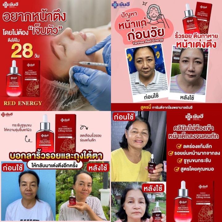 เซรั่มยันฮีแดง-เซรั่มยันฮีเรด-yanhee-red-energy-lifting-serum-30ml