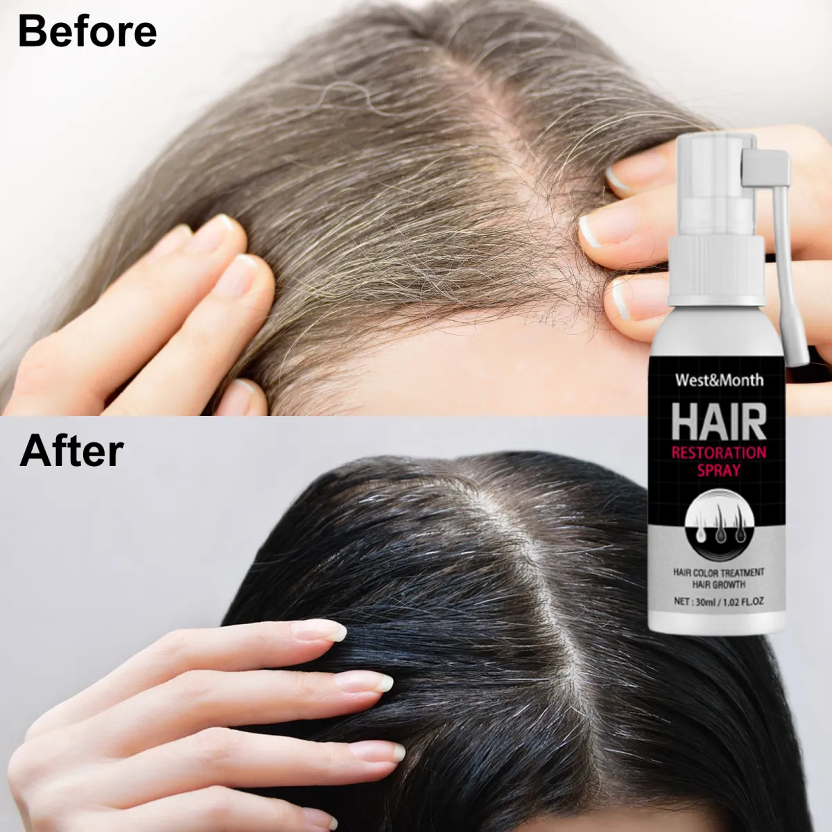 Black Hair Growth Spray Prevent White Hair Restore Melanin Serum Anti-Hair  Loss Treatment Repair Dry Damaged Essential Care 30ml | Lazada
