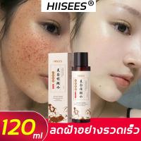 HIISEES รักษาเกลื้อน, เอสเซ้นส์หน้าใส, ครีมไวท์เทนนิ่งกระ, มาสก์ไวท์เทนนิ่งกระ, น้ำนมทำความสะอาดกระ, ช่วยให้ใบหน้าฟื้นฟูความขาว, ไม่มีจุดด่างดำบนใบหน้า, และปรับผิวขาว (ใช้เกลื้อน, ชุดกำจัดกระ)