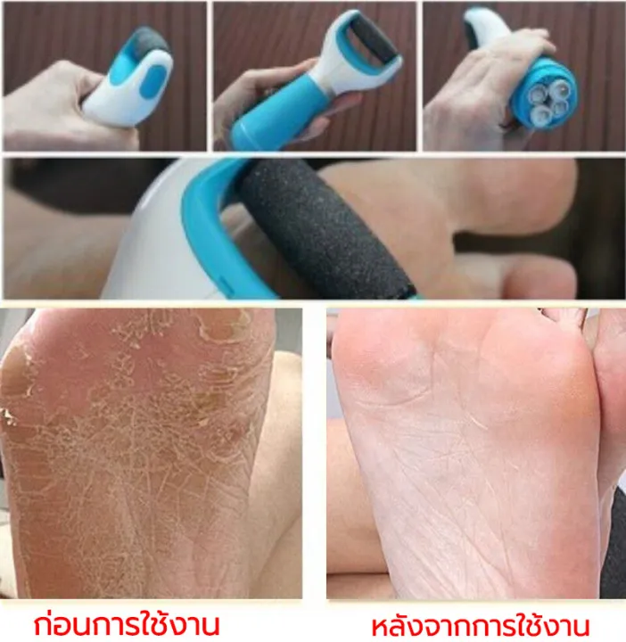 การอัพเกรดใหม่-shangchen-เครื่องขัดเท้า-ผลัดเซลล์ผิวที่ตายแล้ว-ถอดล้างทำความสะอาดได้-ปลอดภัยและไม่เจ็บเท้า-ชาร์จ-usb-ที่ขัดเท้าแตก-ที่ขูดส้นเท้า-ที่ขัดส้นเท้าแตก-ที่ขัดส้นเท้า-ขัดส้นเท้าแตก-เครื่องขัด