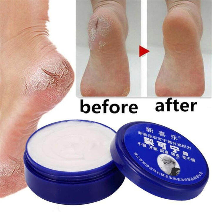 Herbal Anti Crack Foot Cream Oil AntiDrying Crack Feet Cream Heel