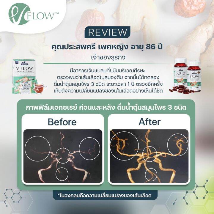 v-flow-30-capsule-สารสกัด-สมุนไพร-ขิง-พุทราจีน-เห็ดหูหนูดำ-จากงานวิจัย