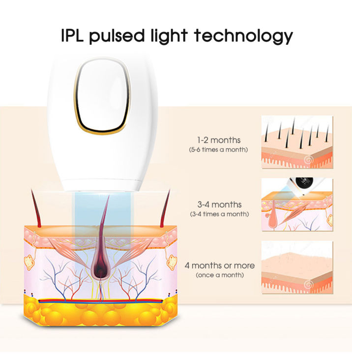 เครื่องเลเซอร์กําจัดขนถาวร-เลเซอร์น้ำแข็ง-เครื่องกำจัดขน-hair-removal-laser-เลเซอร์กำจัดขน-เลเซอร์ขนรักแร้-เครื่องกำจัดขน-laser-permanent-hair-removal-device