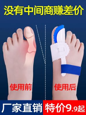 Boutique Big Mother Toe Corrector Men and Women Severely Bending Hallux Valgus Artifact Big Foot Bone Toe Separator