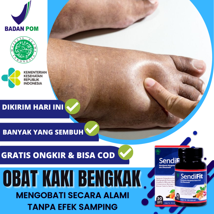 Obat Kaki Bengkak Obat Kaki Bengkak Di Apotik Obat Kaki Bengkak