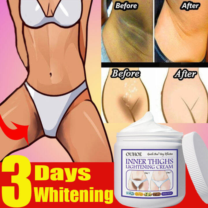 Private Parts Whitening Cream Bikini Underarm Inner Thigh Whitening