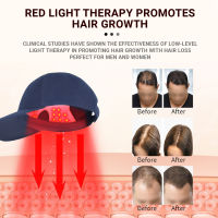 Red Light Tpy LED โคมไฟลูกปัด Hair Growth หมวกผม Fast Growth 650nm Hair Care Anti-Hair Loss ปรับปรุง Depression Dementiahot