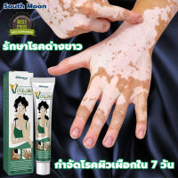 ?7วัน เห็นผล?South Moon ครีมทาด่างขาว 20g สารสกัดจากสมุนไพร ไม่ระคายเคือง ใช้ได้ทั้งร่างและทุกวัย ผลิตภัณฑ์กระตุ้นการสร้างเม็ดสีของผิว โรคด่างขาว โรคผิวหนัง ผลิตภัณฑ์ Vitiligo ด่างขาวที่หน้า ด่างขาวที่หลัง ด่างขาวที่แขน ด่างขาวที่ขา ยาด่างขาว