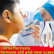 Kem seo Dermatix Ultra hỗ trợ làm phẳng mềm và mờ sẹo lồi sẹo thâm sẹo phì
