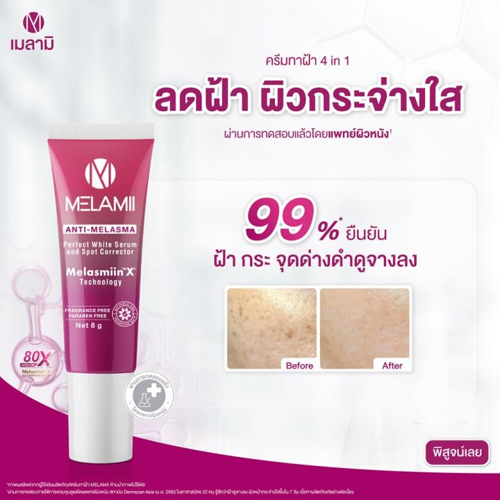 ครีมทาฝ้า-เมลามิ-ลดฝ้า-กระ-จุดด่างดำ-melamii-anti-melama-perfect-white-serum-ลดฝ้า-กระ-ผิวใสใน-7-วัน-ใช้ต่อเนื่อง-ไม่แพ้-ไม่ดื้อยา