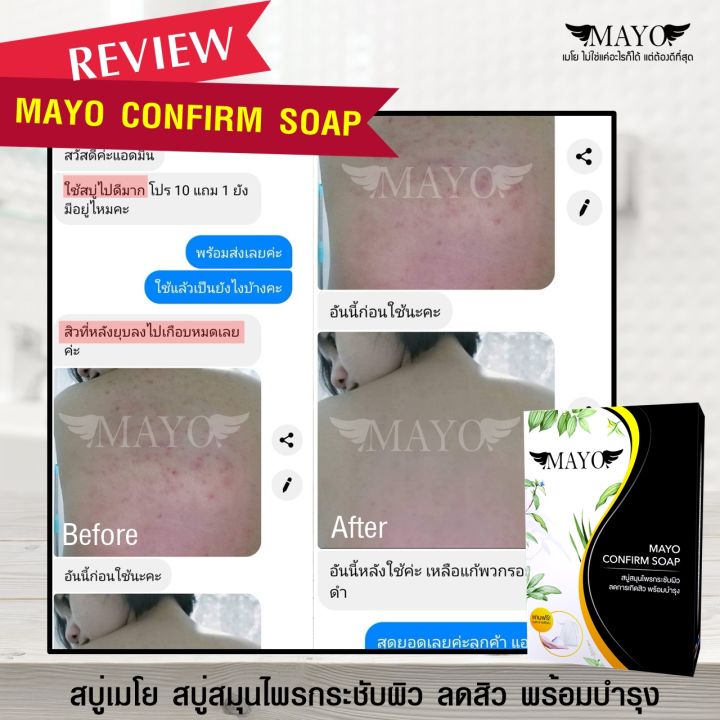 สบู่เมโย-หน้าใส-กระชับผิว-ลดสิว-พร้อมบำรุงให้ขาวใส-mayo-soap-สารสกัดจากธรรมชาติมากกว่า-10-ชนิด