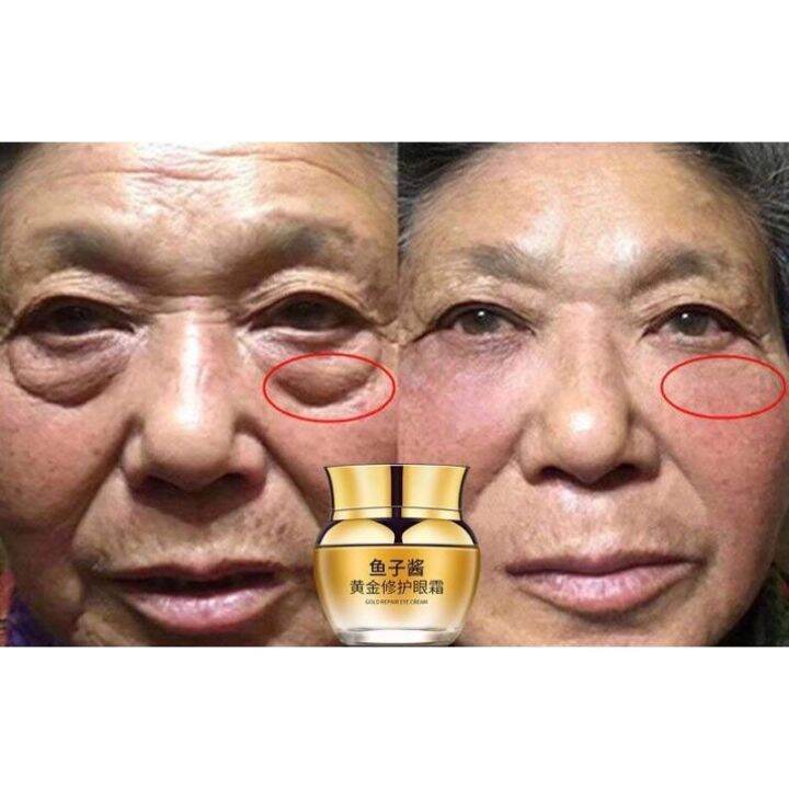 Adakah Krim Mata Sangat Diperlukan?