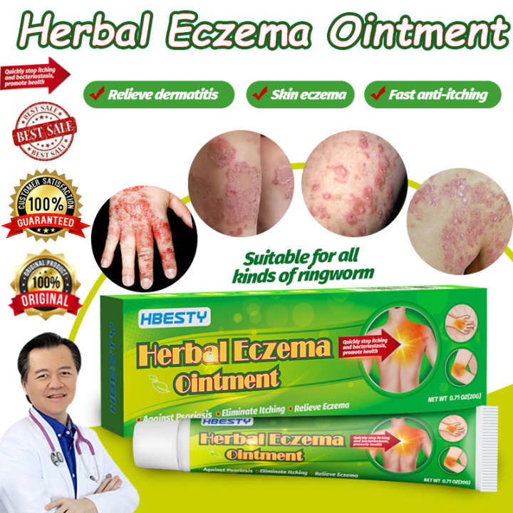 gamot sa kati kati sa balat buni ointment atoderma cream original ...