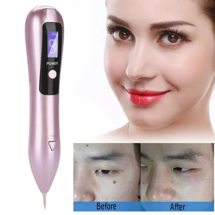 Digital Portable Cautery Machine for Home Use Skin Tag Removal, Warts Removal, FlatWarts