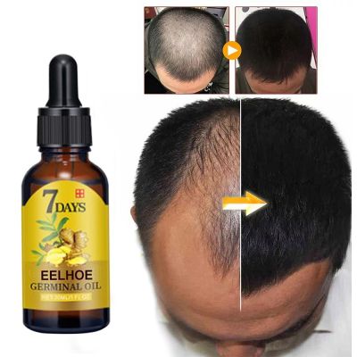 Hair Growth Products For Man Woman Fast Regrow Hair Oil Restore Hair Roots Hair Loss Treatment Scalp Baldness Repair Hair Care