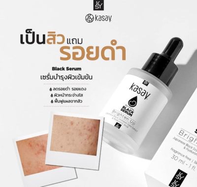 1 แถม 1 เซรั่ม ถั่วเหลืองดำญี่ปุ่น Kasay Black Serum ปริมาณสุทธิ 20 ml